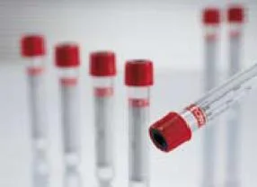 Vacuette Z Serum Clot Activator Venous Blood Collection Tube